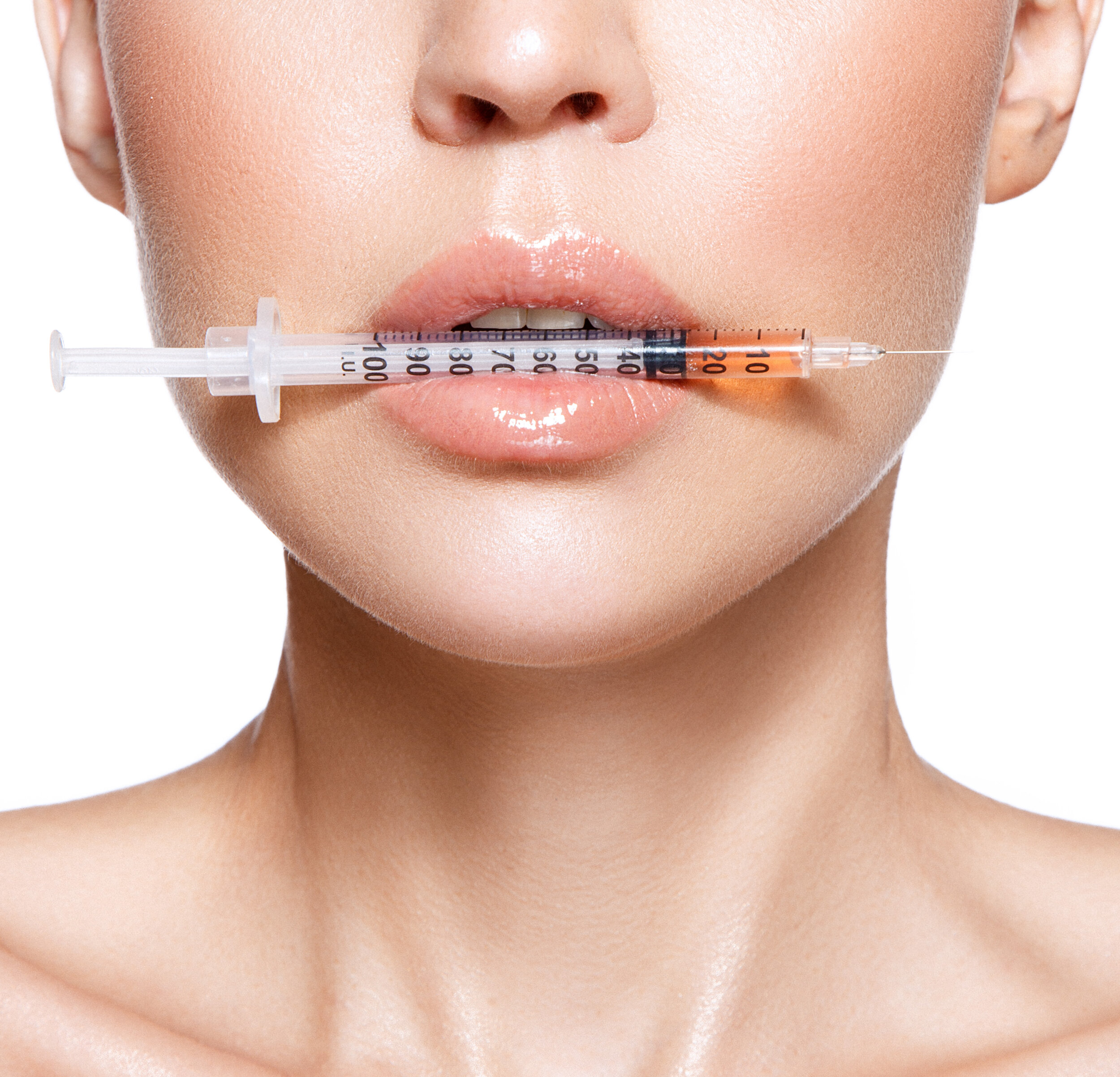 lipofilling-nedir
